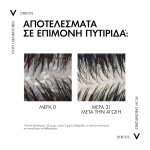 VICHY Dercos Anti-Dandruff DS Refill 390ml