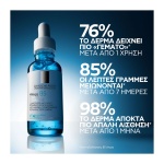 Αντιρυτιδικός ορός για επανόρθωση και αναπλήρωση