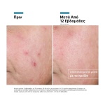 SkinCeuticals Advanced RGN-6 Προηγμένη Κρέμα Ανάπλασης & Αντιγήρανσης